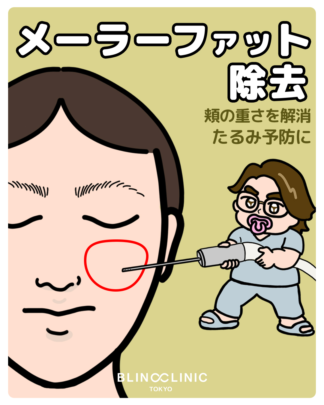 メーラーファット除去