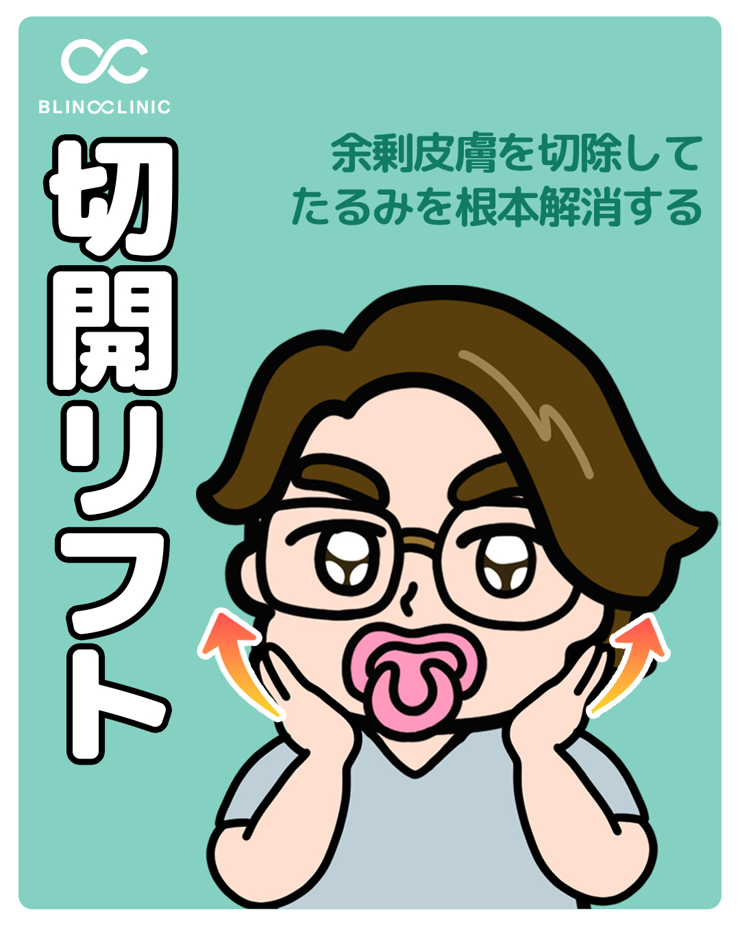 切開リフト