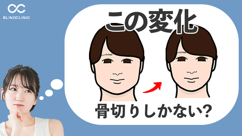 「骨切りしかない」と思っていませんか？実は脂肪吸引で改善できるケースがあります