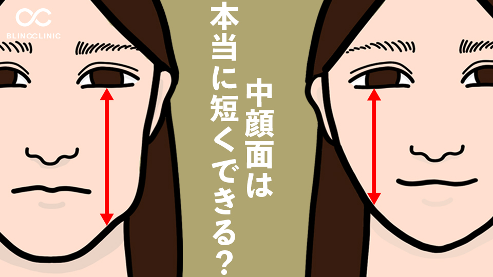 中顔面は本当に短くできる？目の位置ではなく「見え方」を変える方法を美容外科医が解説