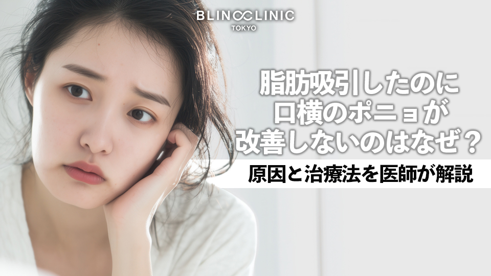 顔の脂肪吸引をしたのに口横のポニョが改善しないのはなぜ？｜原因と治療法を医師が解説