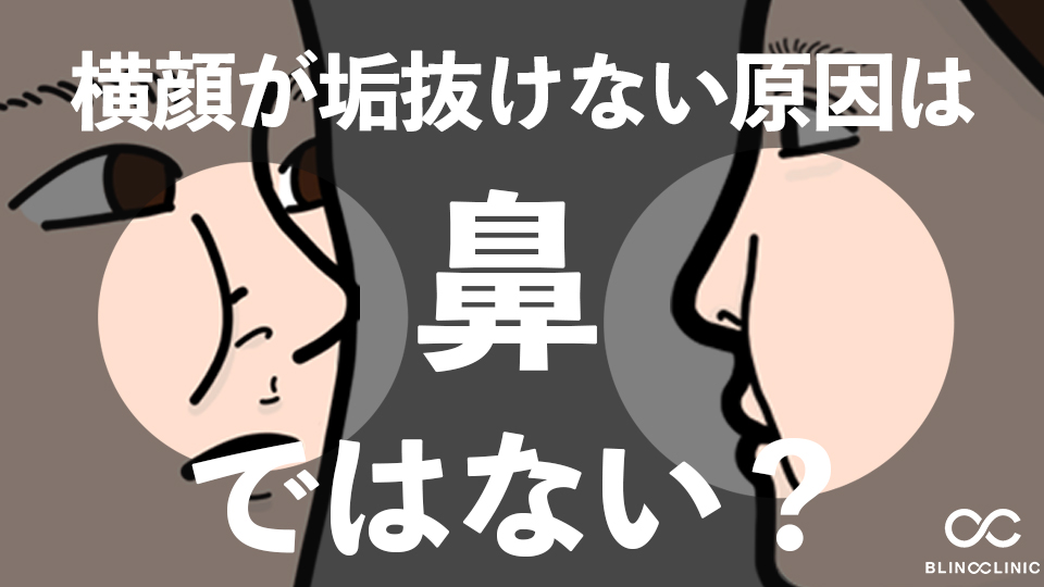 横顔が垢抜けない原因は鼻ではない？頬のボリュームが横顔の印象を左右する理由