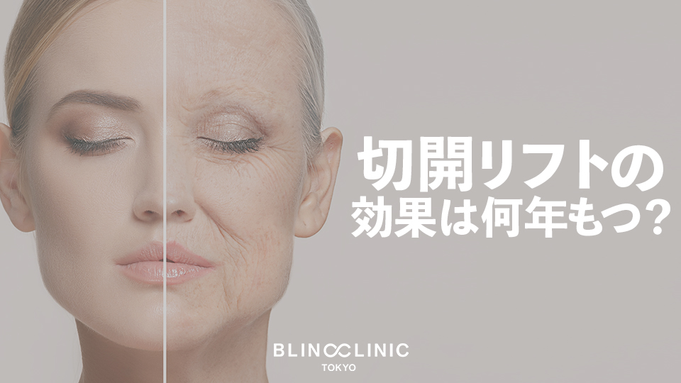 切開リフト（Deep Plane Facelift）の効果は何年もつ？