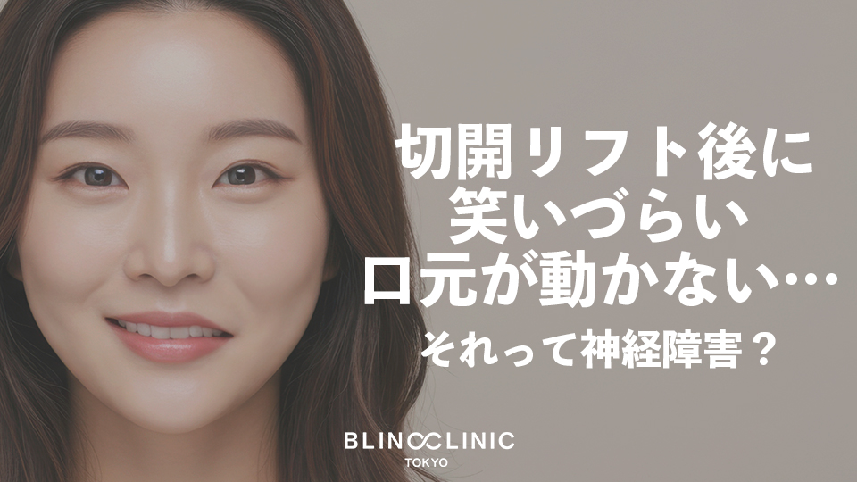 切開リフト後に笑いづらい・口元が動かない…それは神経障害？症状・回復期間・予防法を形成外科専門医が解説